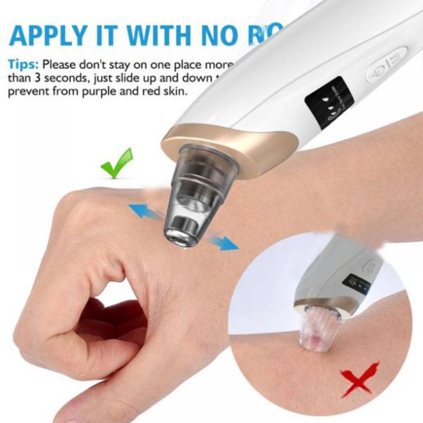 Electric Suction Blackhead Remover